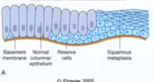 Near the basement membrane or wherever stem cells are because they are the ones that form new cells
