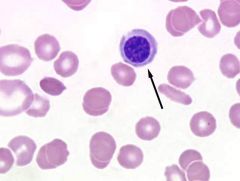Identify the cell indicated by the arrow.