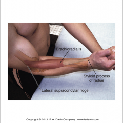 Origin: Lat.Supracondylar ridge
Insertion: styloid process
Action: Elbow flexion, supination/pronation radioulnar