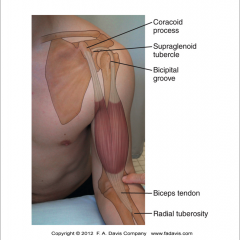 Origin: Long head- Bicipital glenoid groove
            Short Head- coracoid process
Insertion: Radial Tuberosity
Action: GH flexion, elbow flexion, supination
