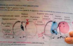 right venous valve & SA orifice --> cristae terminalis