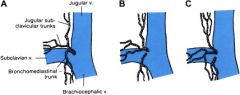 subclavian & cephalic veins unite (L&R)
Central venous access.
Where lymph drains.
