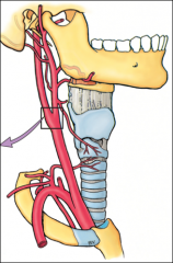 bifurcation of carotid arteries, anterior  to SCM, upper border of thyroid cartilage
