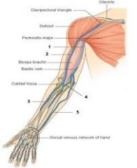 superficial vein upper limb
groove between deltoid & pec major
