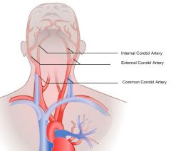 bifurcation of carotid arteries, anterior  to SCM, upper border of thyroid cartilage.
External- anterior supply