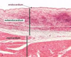 endothelium, basal lamina, think layer callgen, dense layer CT, subendocardium (loose CT- impulse conducting system)