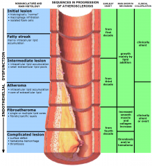 fibrofatty atheroma (plaque)