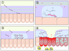 CHRONIC infection :          lies in mucus layer
secretes inflammatory agents
weaken mucosal barrier --> breakdown --> HCl & pepsin attack