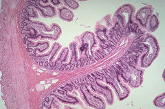 JEJUNUM- tallest villi, plicae circularis, goblet cells and crypts of Lieberkuhn

ILEUM- Peyer's patches, smaller villi & crypts, less prominent plicae, goblet cells