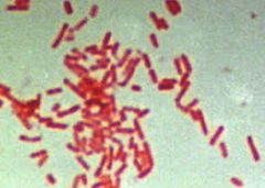 LARGE AEROBIC BACILLI 
GUT commensals
E.coli, Klebsiella, proteus