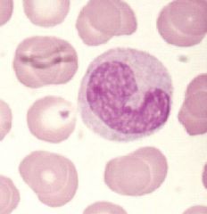 Monocyte; Agranulocyte