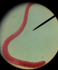 Morphology Trichinella spiralis
key features (female pictured)