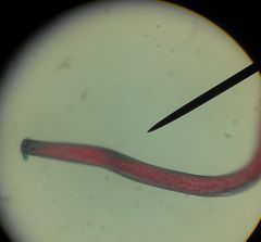 Threadlike worm; stichosome esophagus (same as Trichuris trichura) 
Single ovary or testis
No spicule but can have a spicule sheath that can act as a spicule
females significantly larger
males: copulatory papilla on each side of terminal anus/cloaca