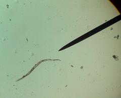 Strongylididae
human intestinal threadworm