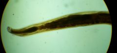 Ancyclostomata duodenale host and location on host? (female pictured)
geography?