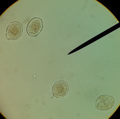 Ascaris lumbridoides 
telling males from females? 

(pictured, unfertilized eggs. they're somewhat longer than fertilized eggs)