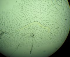 curved tail
single testis
tail is broadly rounded, has single spicule
lateral caudal alae