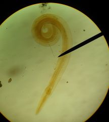 disease called enterobiassis
human pinworm eats epithelial cells and bacteria in intestinal tract. Low cost to host.

Not symptomatic in small numbers.

pictured: juvenile form