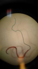 Schistosome japonicum
