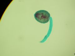 Fasciolidae Fasciola hepatica
Cercaria