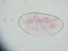 Fasciolidae Fasciola hepatica
eggs
