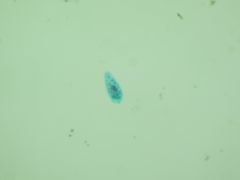 Fasciolidae Fasciola hepatica
miricidium
