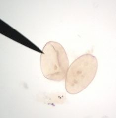 eggs hatch in water to miracidia-penetrate snail-sporocyst-rediae-cercaria-cercaria encyst into metacercaria on plant (e.g. water chestnut, Lotus)-consumed by final host (pigs, humans) and develop in intestines