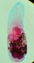 What trematode is this?
What group is it in?
Identify the ovary and testes in this poor quality image.