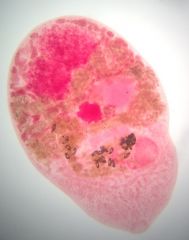 What trematode is this?
What group is it in?
what disease is it associated with?