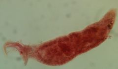 What trematode is this?
What group is it in?