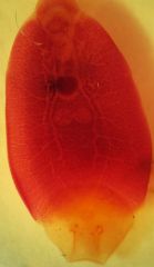 Entobdella.
Monogene. Flatfish ectoparasite