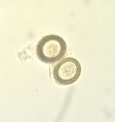 (Taeniidae) Taenia pisiformis aka dog tapeworm.
Eggs of T. pisiformis pictured above.