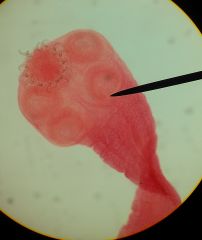 (Taeniidae) Taenia solium aka pig tapeworm
pig;human
intestines
22-32 hooks of two sizes on the scolex

very dangerous for humans to get the eggs, humans are not int. host
