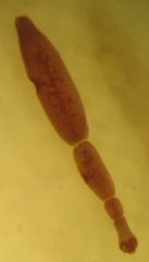 Life cycle of the cestode (Taeniidae) Echinococcus granulosus