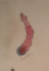 Life cycle of the cestode (Taeniidae) Echinococcus multilocularis