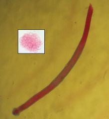 (Dilepididae)	Dipylidium caninum aka dog tapeworm
flees, lice; dogs, cats, humans								scolex has retractable rostellum with ceveral circles of rose thorn hooks