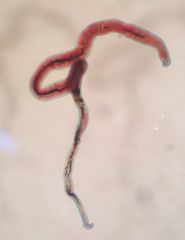Female adults of this Schistosome are thick and symmetrical.