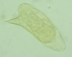 (Trematoda Digenea Stregiformes) Schistosomatidae Schistosoma mansoni
egg, note lateral spine