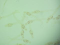 (Trematoda Digenea Stregiformes) Schistosomatidae Schistosoma mansoni
cercaria (pl. cercariae) Note forked tails. (Furocercous)