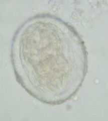 Schistosoma japonicum
They're oval/spherical