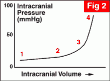 Intracranial pressure - volume