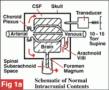 Schema of brain constraints - normal