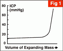 ICP - volume curve