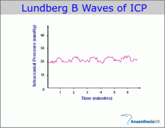 Lundberg B waves