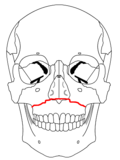 Frakturen kan fås av slag uppifrån på de anteriora tänderna eller i området för alveolarutskotten (Lägre delarna av maxillan)