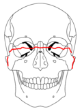 Involverar orbitan och okbågen mm. Ofta efter ett slag mot näsroten eller övre maxillan.