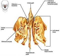 Lies between nasal and sphenoid bones
Forms most of the medial bony region between the nasal cavity and orbits 

Crista Galli- attachment for falx cerebi, the large vertical sheet of connective tissue which lies between cerebral hemispheres 
Crib...
