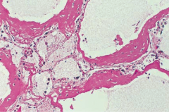What does this histology show?