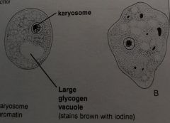 CYST= 1 nuclei with large irreg karyosome w/no periph chromatin
LG glycogen vacuole inclusion (stains brown with iodine)

TROPH= same nuclei as above, no inclusions