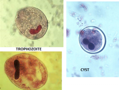 **ONLY ciliate pathogenic to humans
-dysentary, vaginal contamination
-found in feces or intestinal mucosa as troph or cyst = capusule swollowed w/string
-WORLD WIDE but rare in US
-O&P 
txt: tetracycline or metronidazole